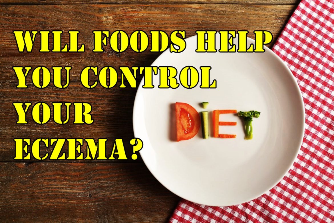 Eczema and diet: Will foods help you control your Eczema?