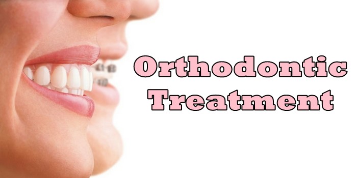 Orthodontic Treatment – Caring for your Teeth and Preventing Dental Problems
