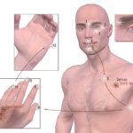 All You Need to Know about Emotional Freedom Technique