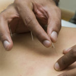 Health and Wellness- What to Expect from an Acupuncturist