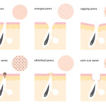 5 Simple Habits that Help Minimize Your Pores