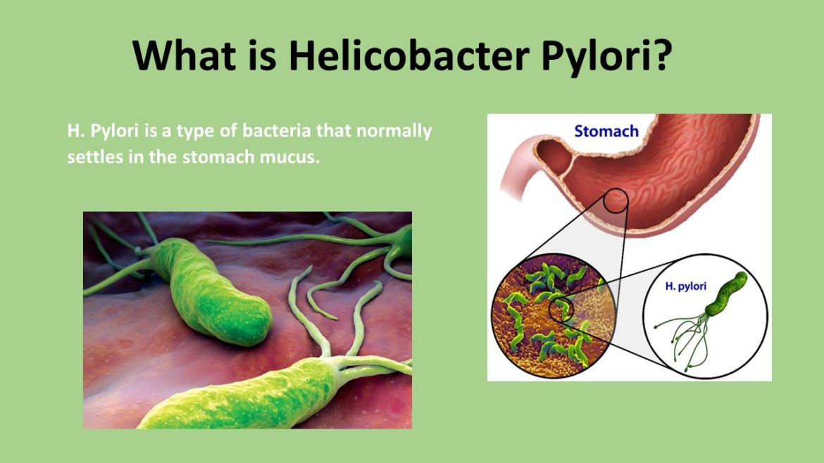 Bacteria del estomago helicobacter pylori tratamiento