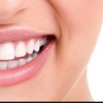 All You Need to Know About Braces