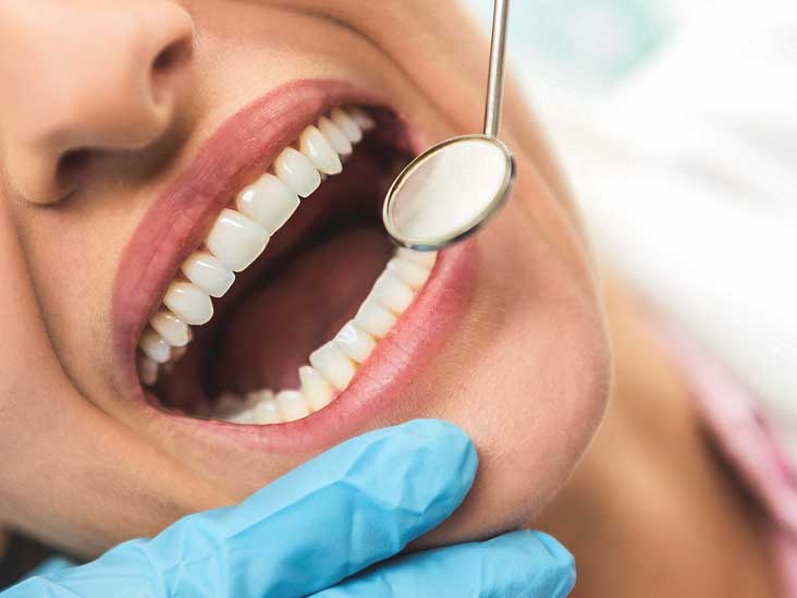 What is Enamel Erosion?