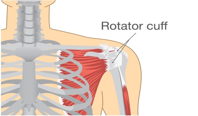 How To Avoid Re-Injury After Rotator Cuff Rehab