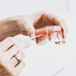 All-on-4 vs All-on-6 Dental Procedures And What You Should Know About Them
