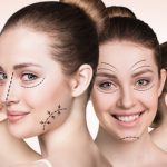 The Benefits of Cosmetic Surgery and How You Feel Long Term