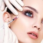 5 Things You Should Know Before Getting Botox