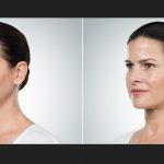 Ways to Reduce Chin Fat