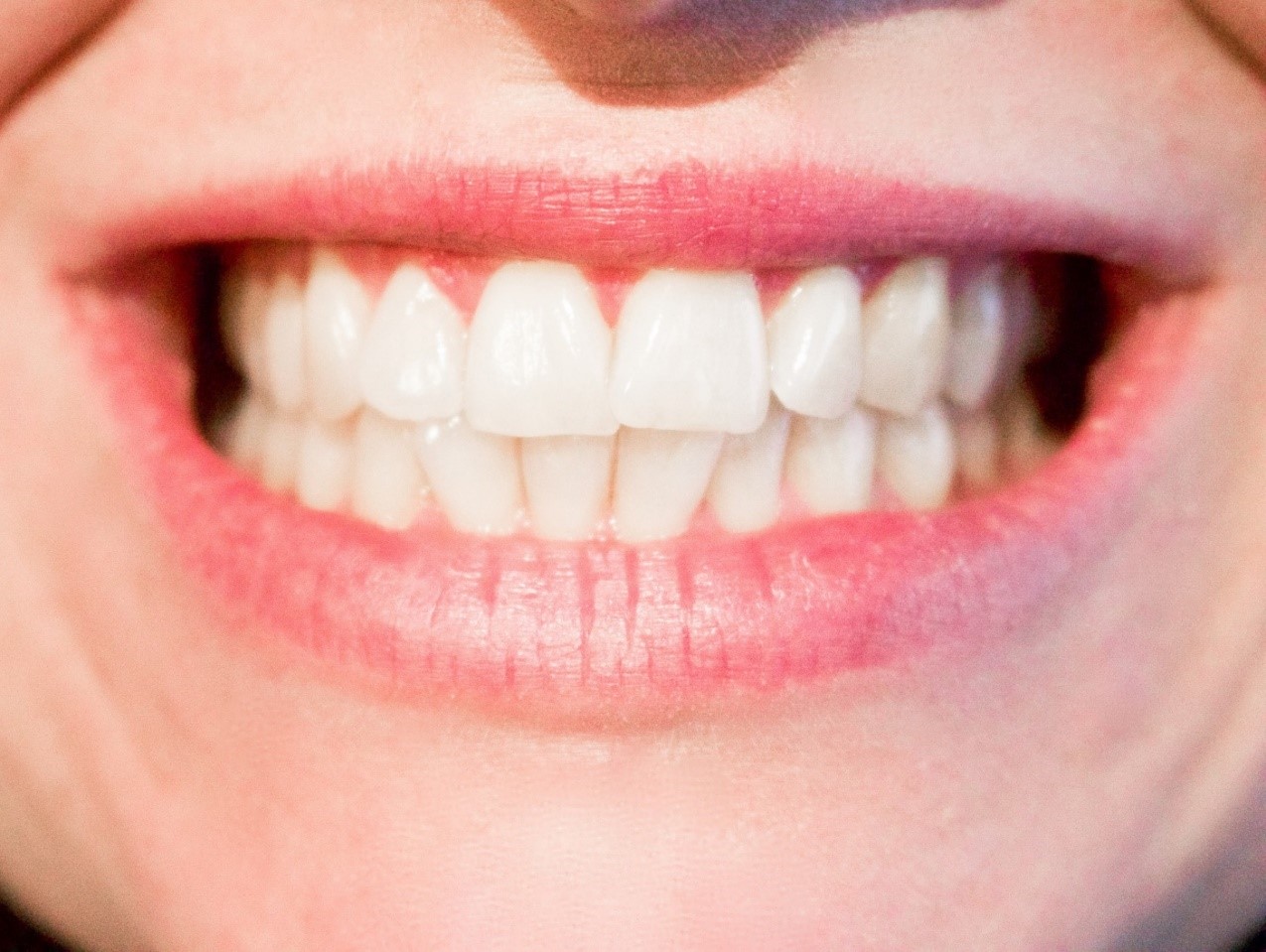 4 Ways Your Dental Health is Impacting Your Quality of Life