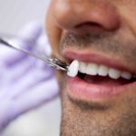 10 Important Things You’ll Hear At The Dentist
