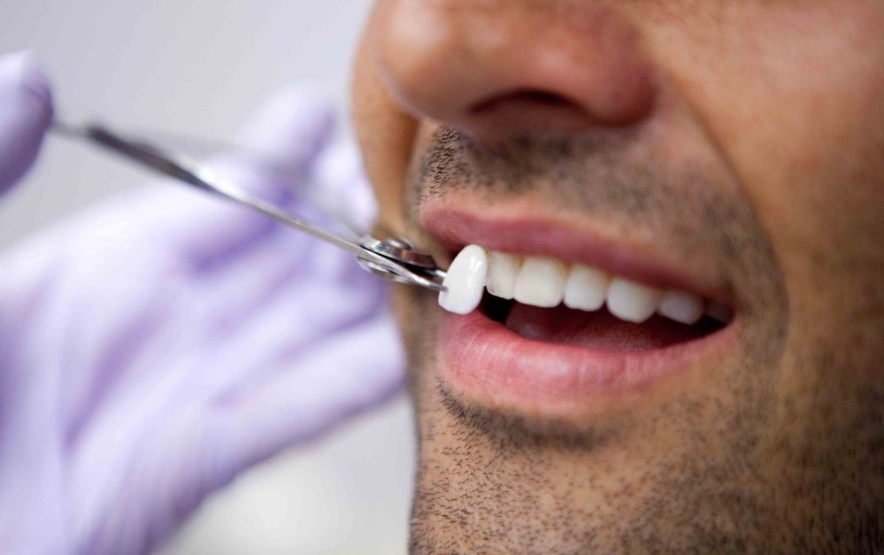 10 Important Things You’ll Hear At The Dentist