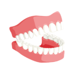 What Causes Tooth Erosion & Tooth Wear?