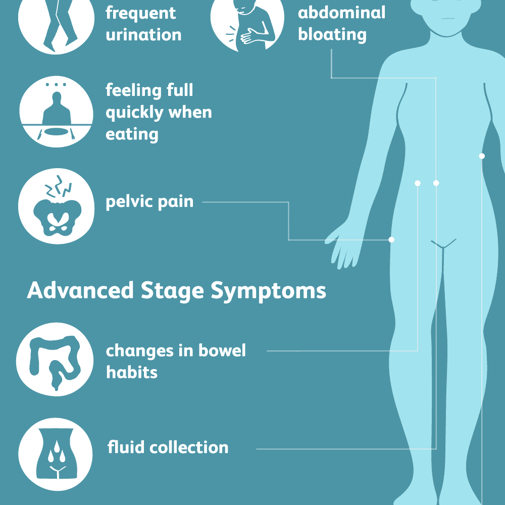 Symptoms of Ovarian Cancer