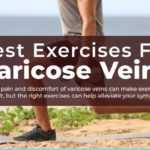 Varicose Vein Exercise Tips