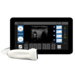 8 Things to Know Before You Buy Portable Ultrasound Equipment