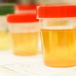 Can You Freeze Urine For Future Drug Tests?
