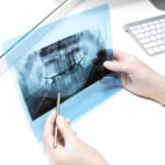 Intra-Oral Radiography: All You Need To Know