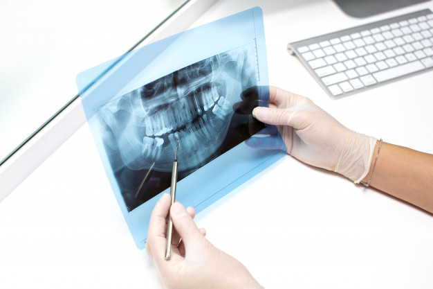 Intra-Oral Radiography: All You Need To Know