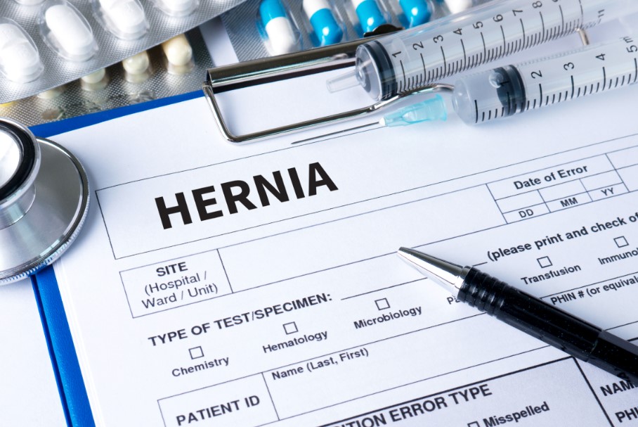 5 Tell-Tale Signs Of Hernia Mesh Complications