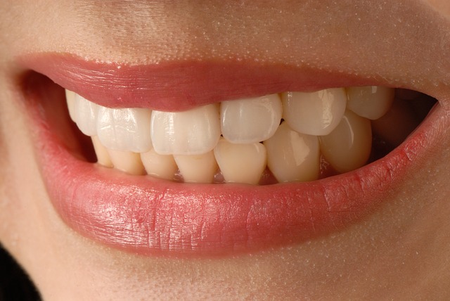 Which Veneers Are Better: Porcelain Veneers Sydney or Resin Veneers?