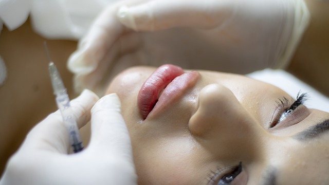 Lip Fillers: Should You Opt or Should You not Opt for it
