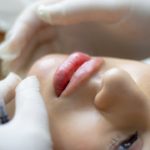 Restore Facial Fullness with Dermal Fillers