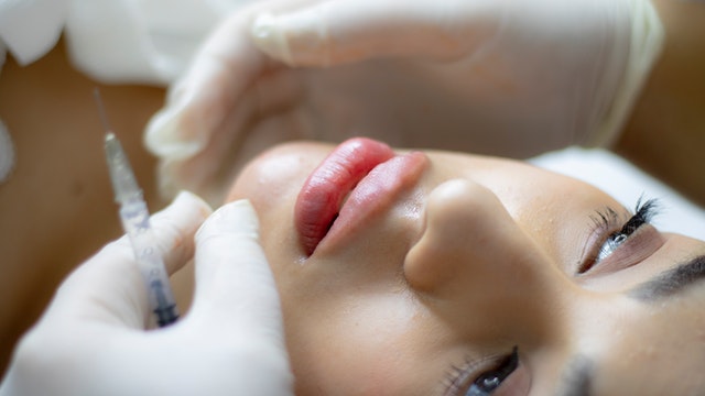 Restore Facial Fullness with Dermal Fillers