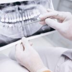 Whom to Trust for a Root Canal Treatment in NYC