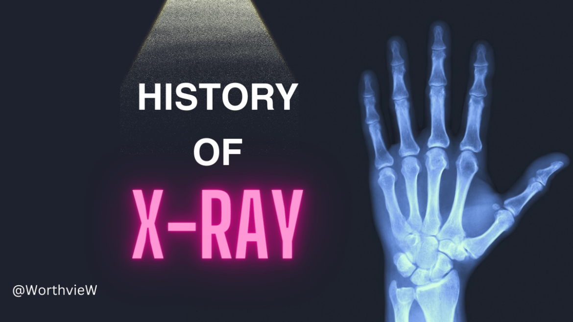 A Brief History of the X-Ray: From Its Invention to the Modern Day!