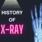 A Brief History of the X-Ray: From Its Invention to the Modern Day!