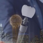 Recent Advances in Dental Implants: Transforming Smiles in Dallas