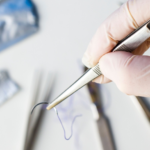 How Do You Choose the Appropriate Surgical Sutures for Implants, and What Key Aspects Should Be Taken Into Account?