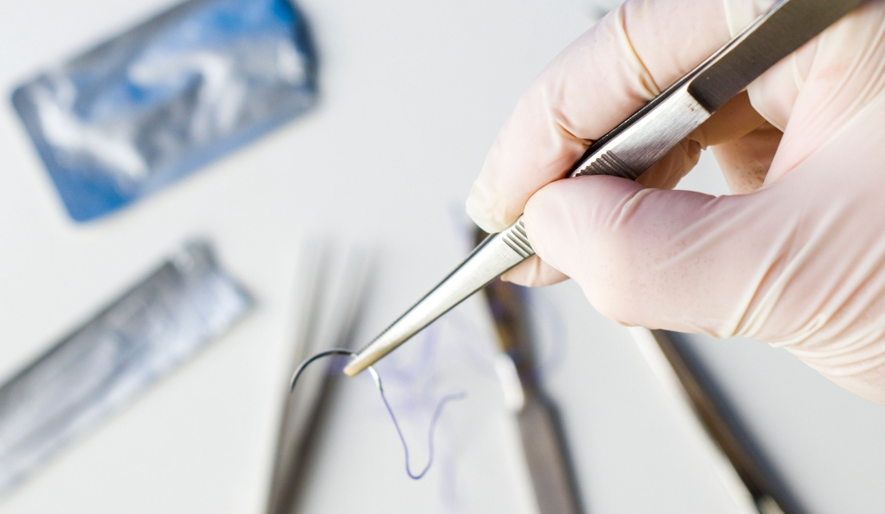 How Do You Choose the Appropriate Surgical Sutures for Implants, and What Key Aspects Should Be Taken Into Account?