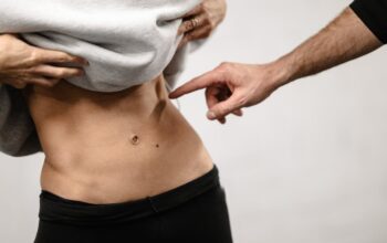 Different Types of Body Contouring