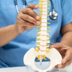 Spinal Cord Injury